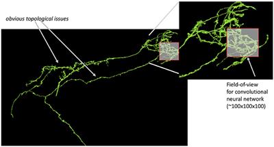 Analyzing Image Segmentation for Connectomics